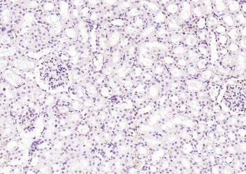 Phospho-STAT3 (Ser727) Recombinant Rabbit Monoclonal Antibody