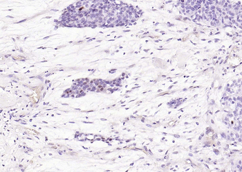 Phospho-STAT3 (Ser727) Recombinant Rabbit Monoclonal Antibody