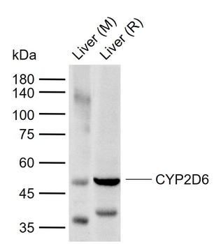 CYP2D6 Rabbit Polyclonal Antibody