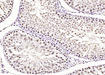 TBP Mouse Monoclonal Antibody