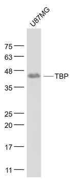 TBP Mouse Monoclonal Antibody