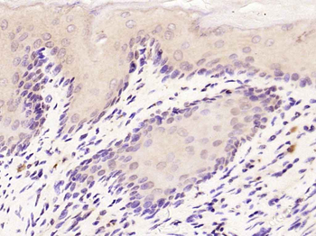 SMAD7 Rabbit Polyclonal Antibody