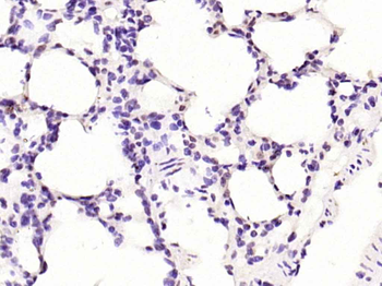 SMAD7 Rabbit Polyclonal Antibody