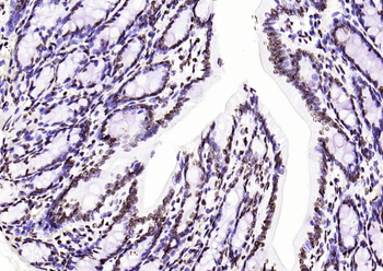 Histone H3 (di methyl K36) Mouse Monoclonal Antibody