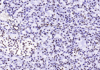 Histone H3 (di methyl K36) Mouse Monoclonal Antibody