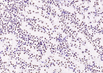 Histone H3 (di methyl K36) Mouse Monoclonal Antibody