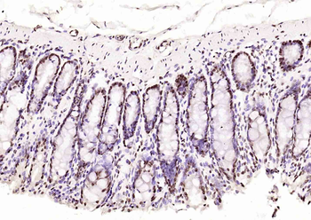 Histone H3 (tri methyl K36) Mouse Monoclonal Antibody