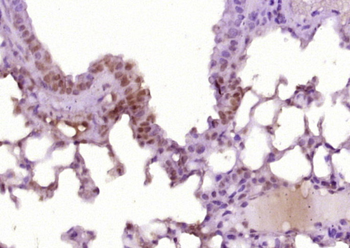 SP140 Rabbit Polyclonal Antibody