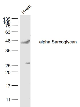 Alpha Sarcoglycan Rabbit Polyclonal Antibody