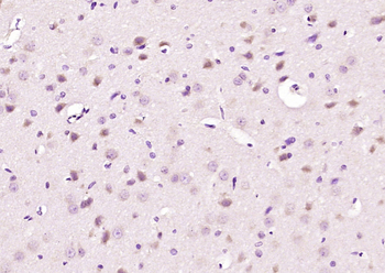 Nesprin 1 Rabbit Polyclonal Antibody