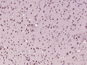 Ctip2 Rabbit Polyclonal Antibody