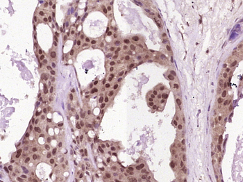 MLH1 Rabbit Polyclonal Antibody