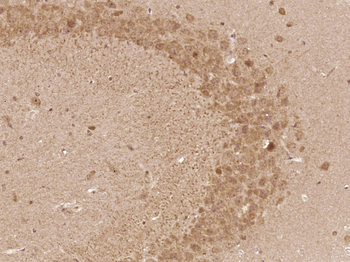 SH2D7 Rabbit Polyclonal Antibody