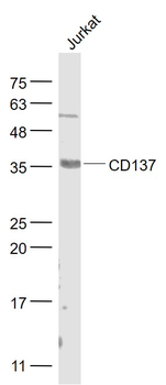 CD137 Rabbit Polyclonal Antibody