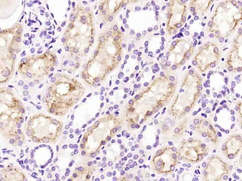 Cystatin-C Rabbit Polyclonal Antibody