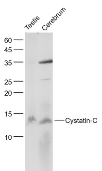 Cystatin-C Rabbit Polyclonal Antibody