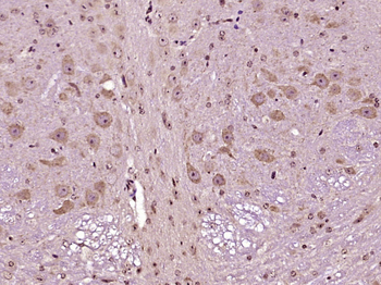 MYPT1 Rabbit Polyclonal Antibody