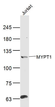 MYPT1 Rabbit Polyclonal Antibody