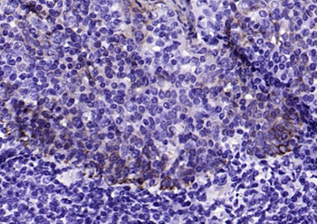 CK17 Mouse Monoclonal Antibody