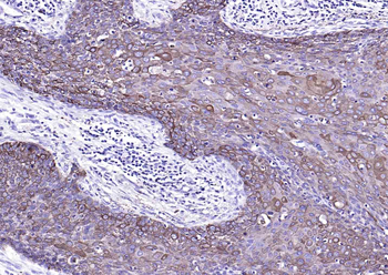CK17 Mouse Monoclonal Antibody