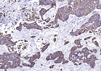 CK17 Mouse Monoclonal Antibody
