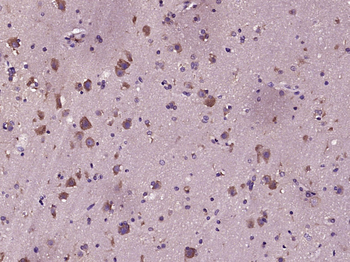 C-erbB-2/HER2 Mouse Monoclonal Antibody