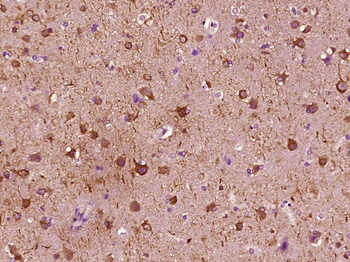 MAP2 Mouse Monoclonal Antibody