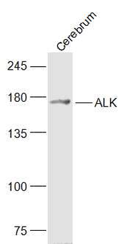 ALK Rabbit Polyclonal Antibody