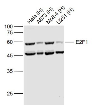 E2F1 Rabbit Polyclonal Antibody