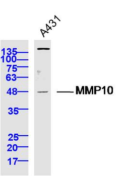 MMP10 Rabbit Polyclonal Antibody