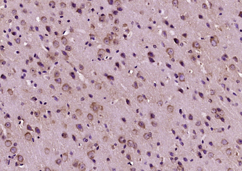 Calcitonin Rabbit Polyclonal Antibody
