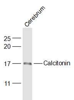 Calcitonin Rabbit Polyclonal Antibody