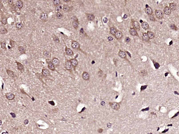 MDM2 Rabbit Polyclonal Antibody
