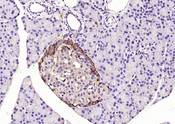 PDX1 Rabbit Polyclonal Antibody