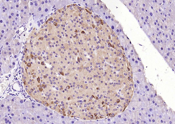 PDX1 Rabbit Polyclonal Antibody