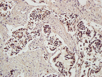 Dnmt1 Rabbit Polyclonal Antibody