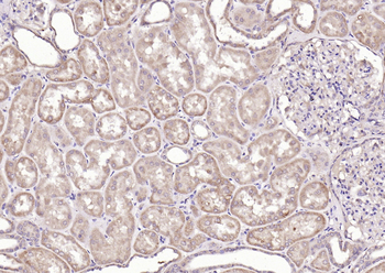 Cathepsin L (heavy chain) Rabbit Polyclonal Antibody