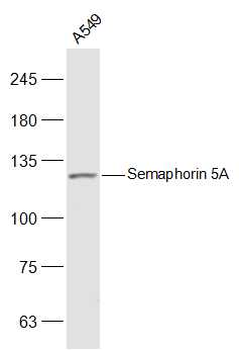 Semaphorin 5A Rabbit Polyclonal Antibody