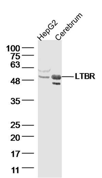 LTBR Rabbit Polyclonal Antibody