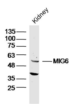 MIG6 Rabbit Polyclonal Antibody