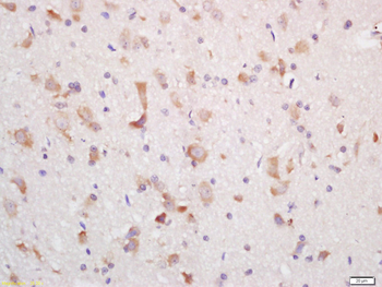 GPR24 Rabbit Polyclonal Antibody