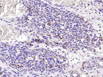 CD200 Rabbit Polyclonal Antibody