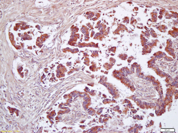 CD200 Rabbit Polyclonal Antibody