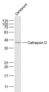 Cathepsin D Rabbit Polyclonal Antibody