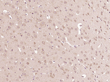 NG2 Rabbit Polyclonal Antibody