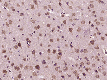 B4GALT6 Rabbit Polyclonal Antibody