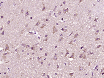 SCLT1 Rabbit Polyclonal Antibody