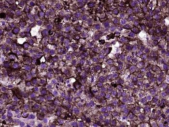 SCLT1 Rabbit Polyclonal Antibody