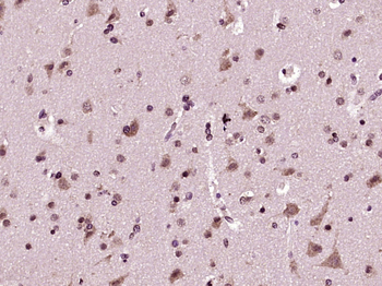 SCLT1 Rabbit Polyclonal Antibody