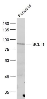 SCLT1 Rabbit Polyclonal Antibody